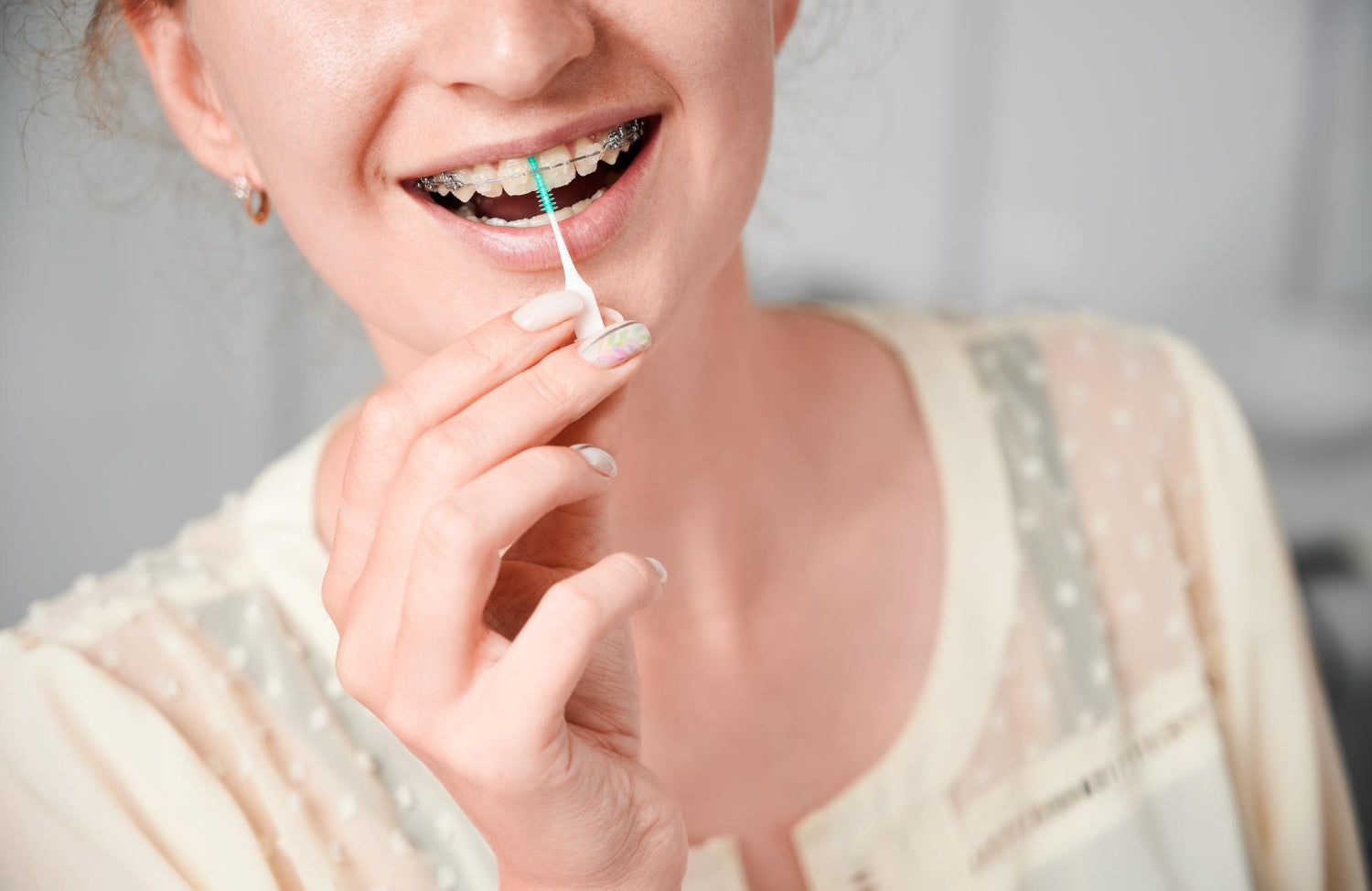Junges Mädchen mit Zahnspange und Interdentalbürste in der Hand
